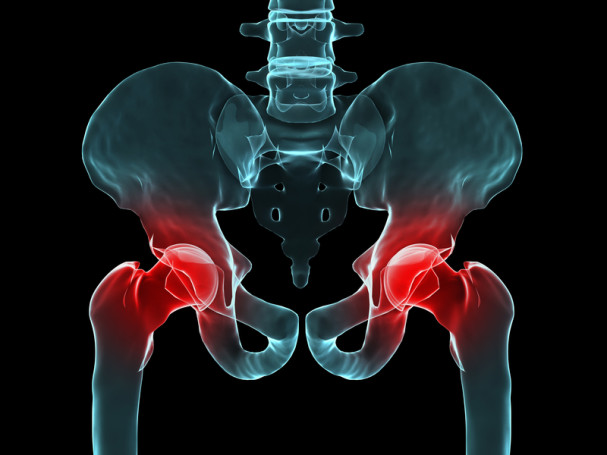 Hip Bursitis Can Cause Pain And Impede Mobility University Health News