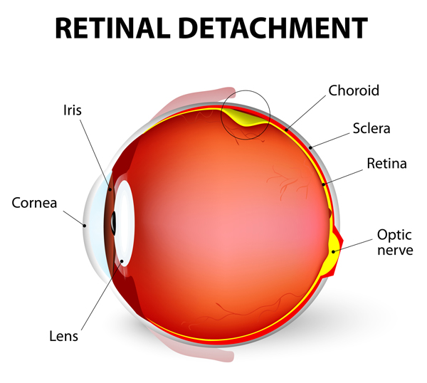 detached retina dog