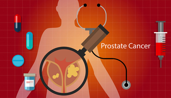 prostate-cancer-stages-university-health-news