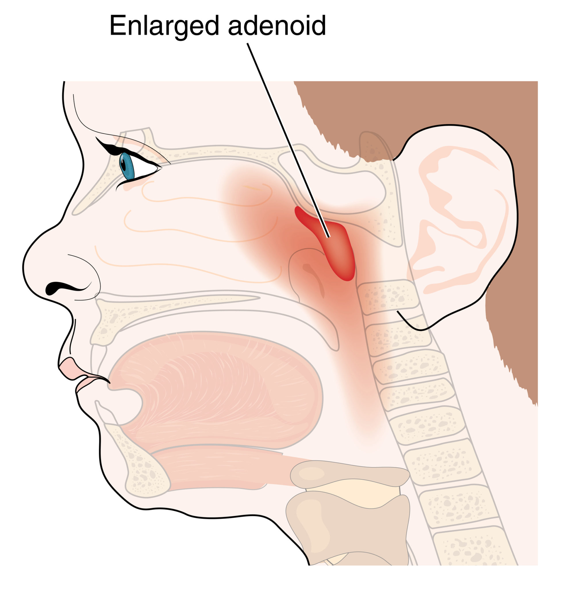 what-are-adenoids-and-what-do-they-do-university-health-news