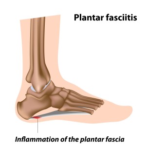 pain in heel of foot
