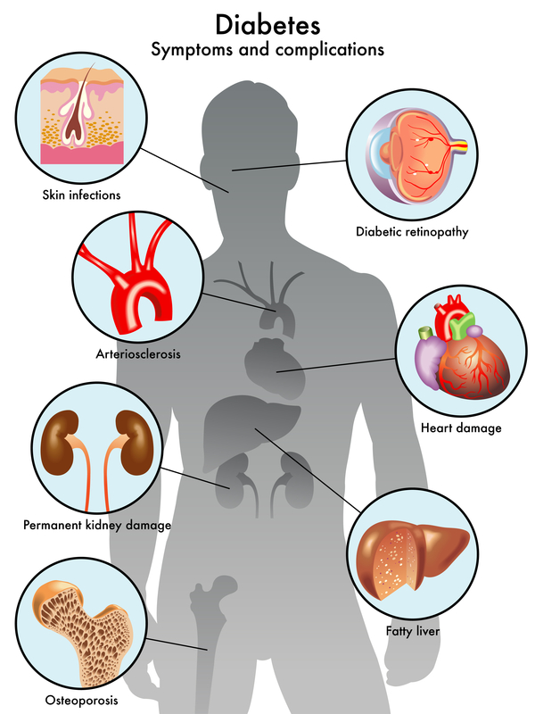 diabetes-signs-and-symptoms-what-are-my-long-term-risks-university