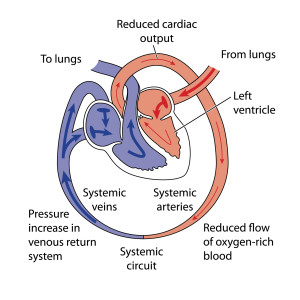 Heart failure is characterized by reduced cardiac output of oxygenated blood to the brain and extremities.