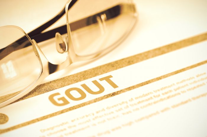 how-long-does-gout-last-university-health-news