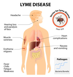 lyme disease and joint pain, headaches, and other lyme disease symptoms