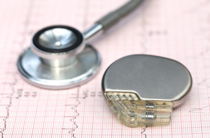 The Pacemaker Our Primer Explains How It Keeps Your Heart S Rhythm In