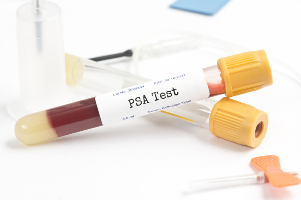 An Abnormal PSA Result: What Comes Next? - University Health News