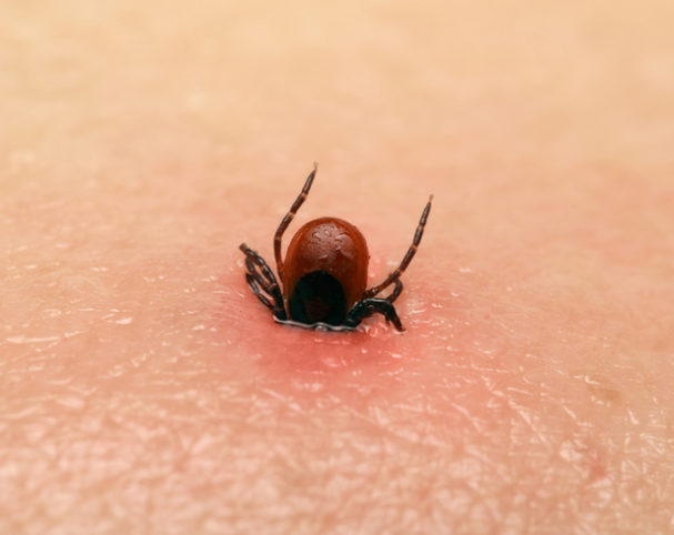 Tick Bite Tale From The Er Doctor Theres A Seed Attached To Me