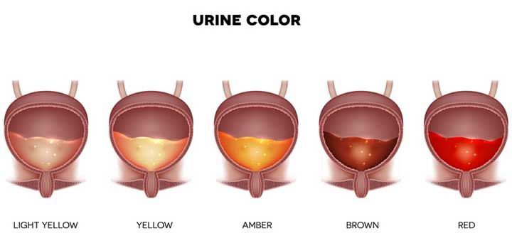 light yellow urine is normal        <h3 class=