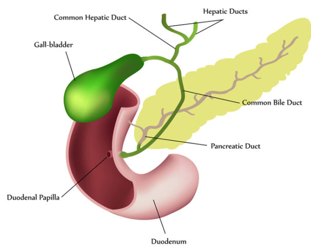 What Causes Gallstones University Health News   What Causes Gallstones 607x489 