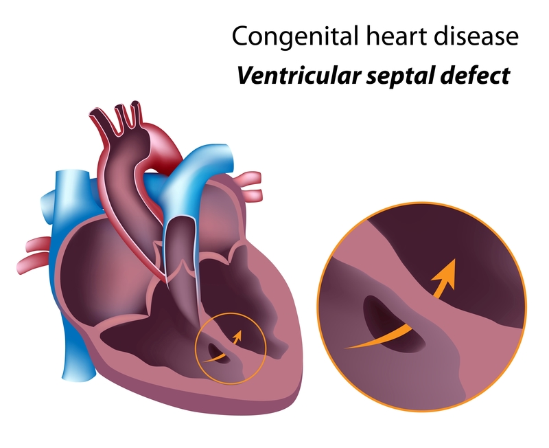 what-is-a-heart-murmur-it-may-be-harmless-or-it-may-indicate-heart