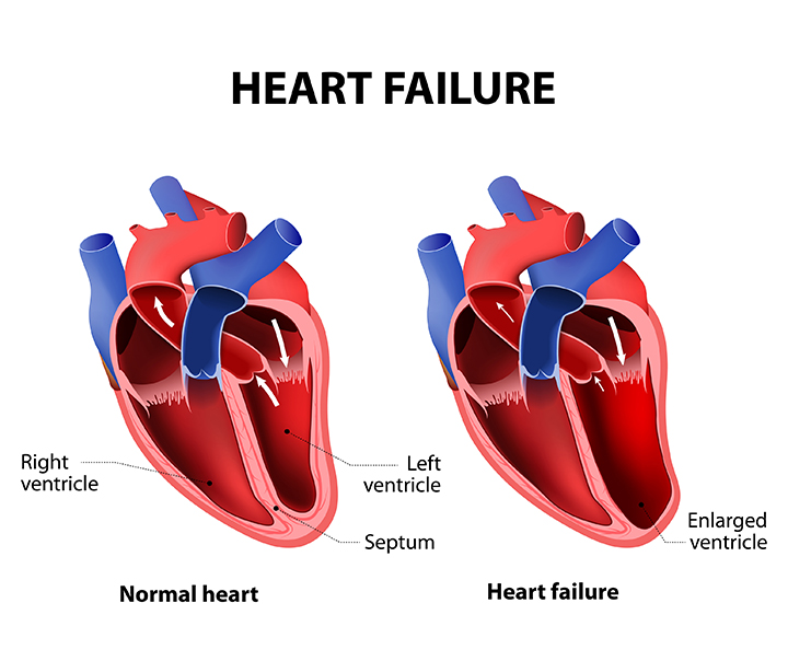 The 4 Heart Problem Symptoms You Shouldn’t Ignore ...