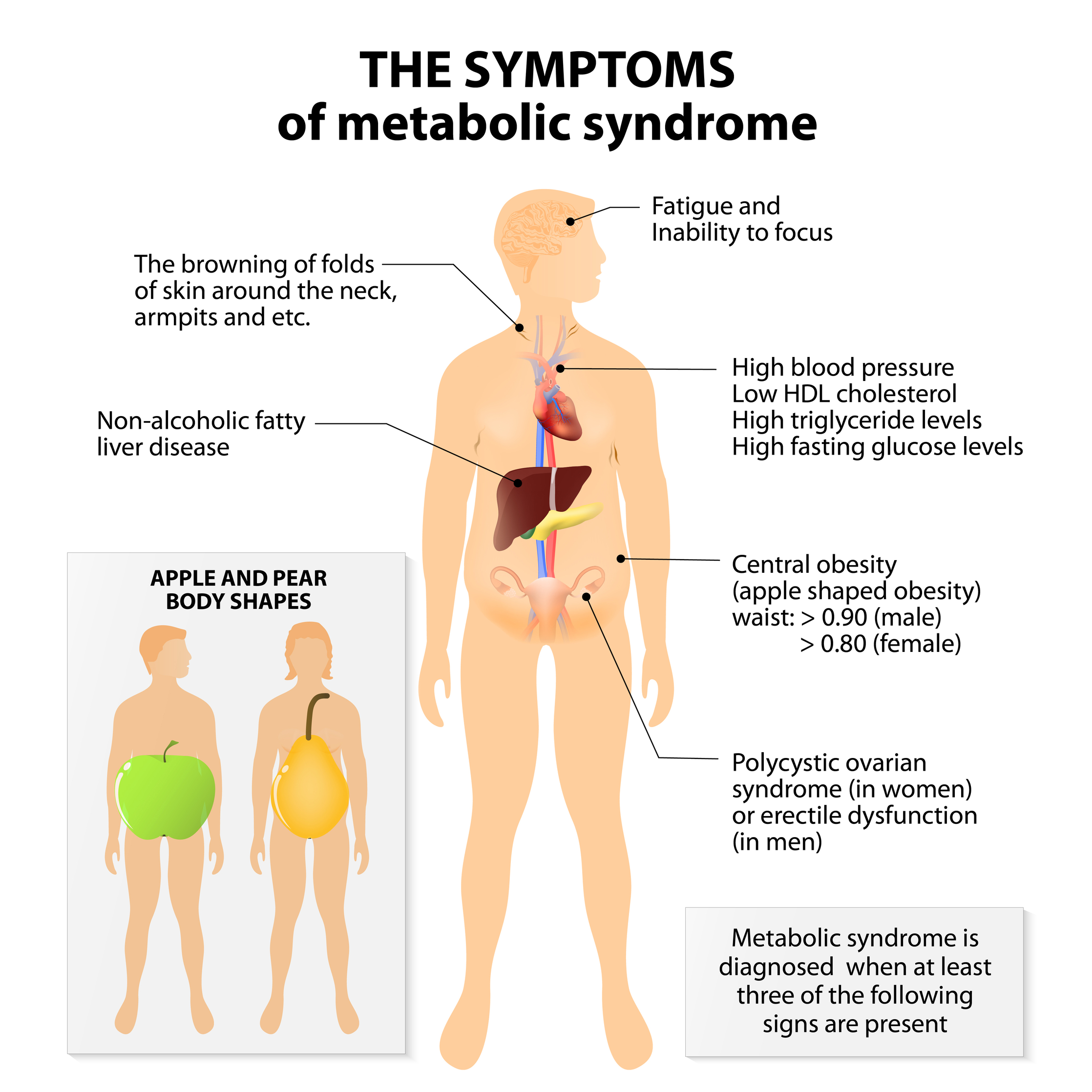 Diabetes Symptoms In Men University Health News pertaining to Symptoms Of A Diabetic for Existing Home